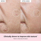 Watermelon Glow Niacinamide Dew Drops